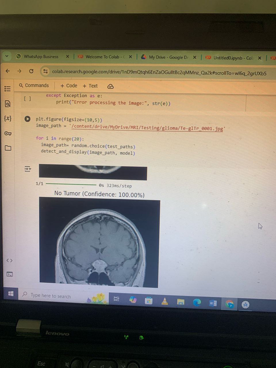 Tumor Detection & Tracking App